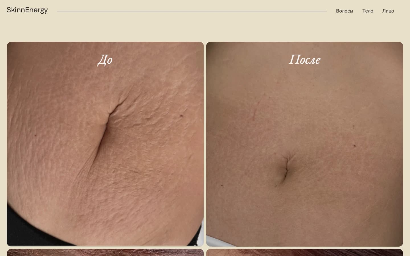 SkinnEnergy keha naha enne ja pärast vaade